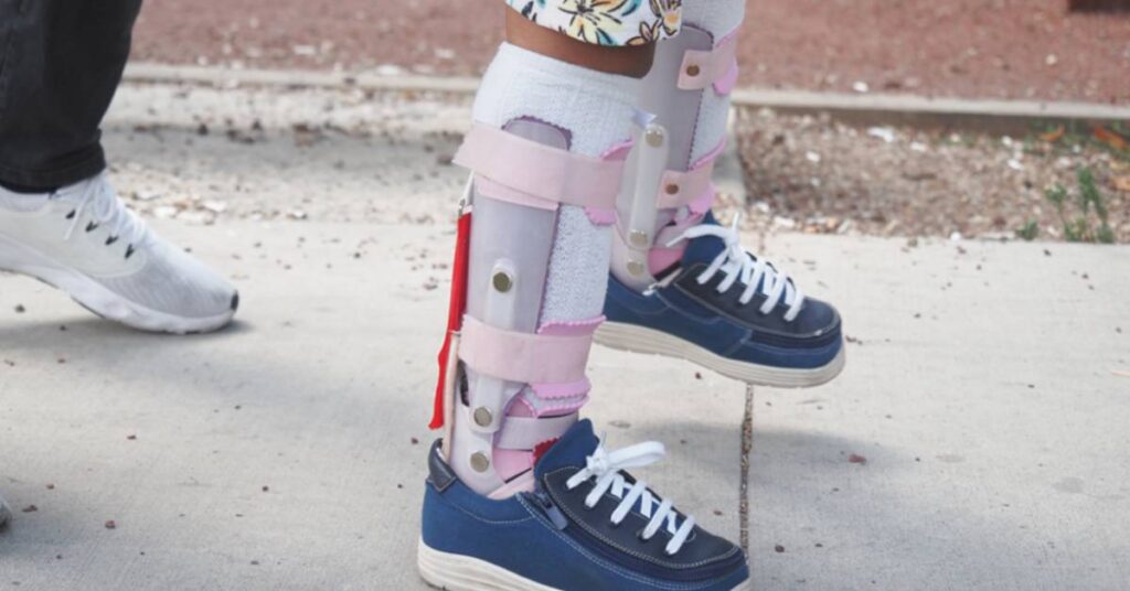 Person wearing a leg brace and blue sneakers standing next to someone's foot.